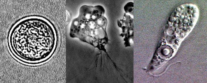 CDC micrographs of Naegleria fowleri