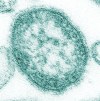 Measles virus